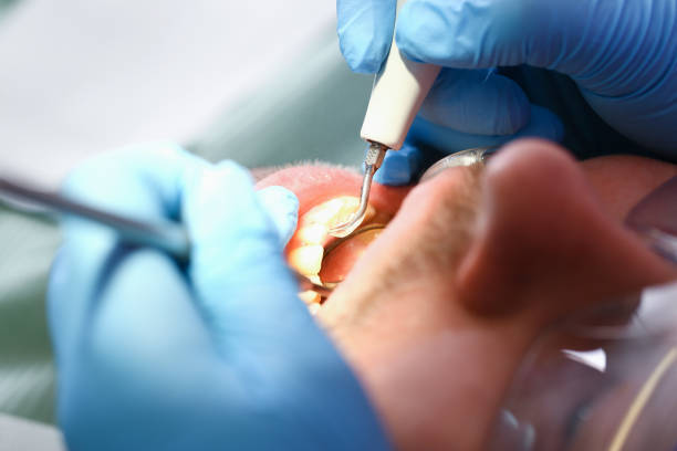 Best Emergency Care for Gum Disease in Hartford City, IN
