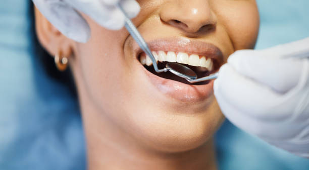 Best Emergency Denture Repair in Hartford City, IN